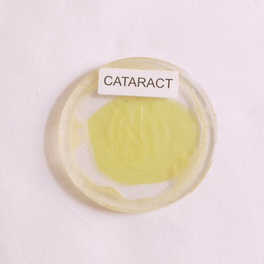 Cataract Simulation Lens